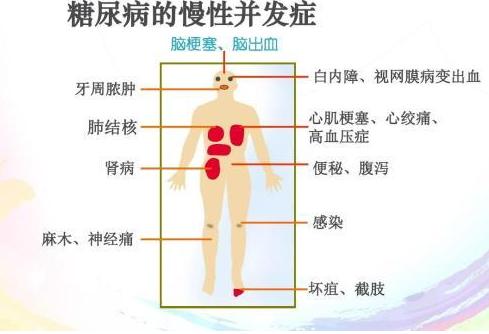 糖尿病无需节食，营养均衡才能降低血糖，五个饮食方法收好